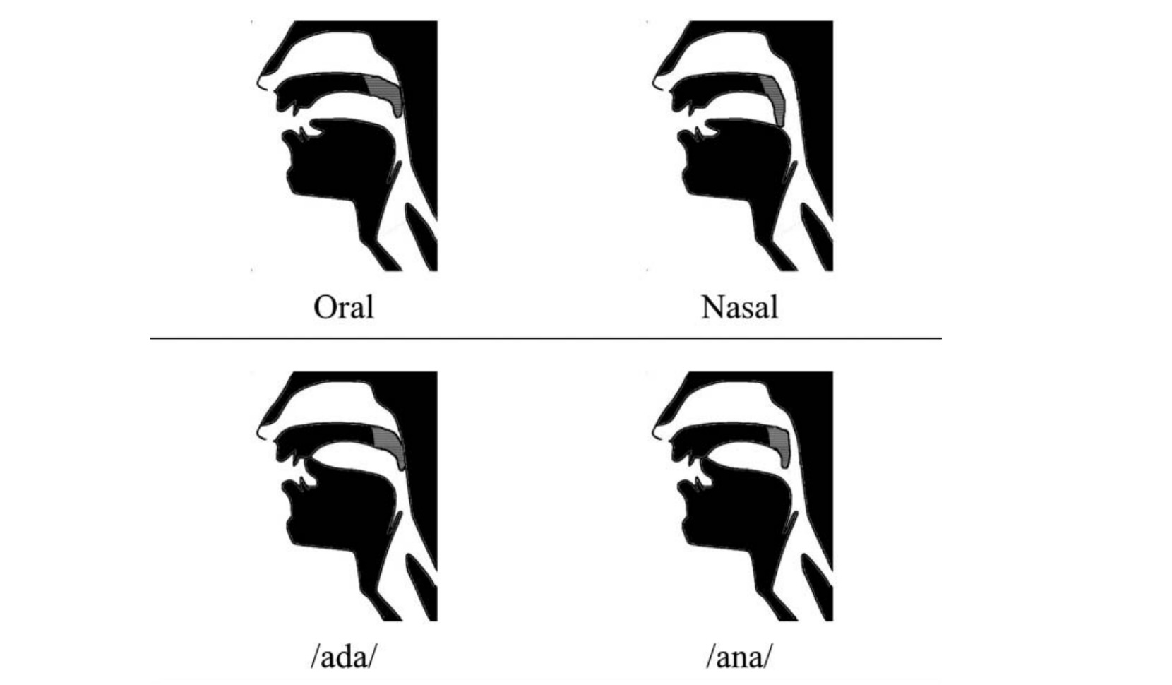 Postural control of the vocal tract affects auditory speech perception